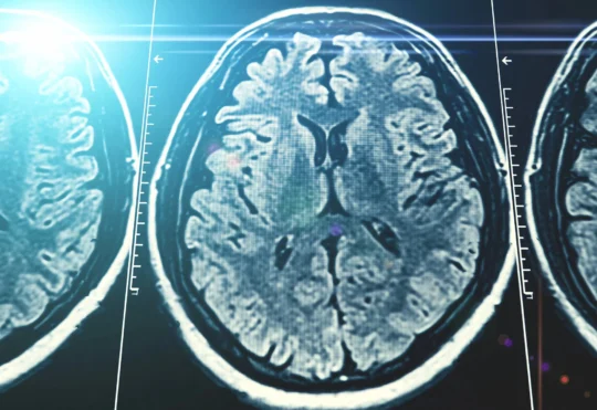 Stigma keeps many Canadians from seeking dementia help