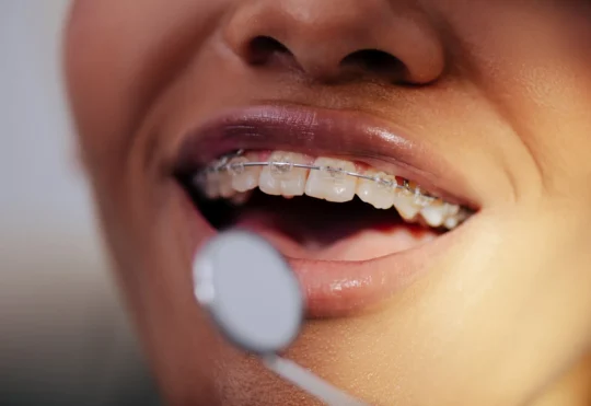 N.S. dental clinics hesitant to enroll in new federal dental plan