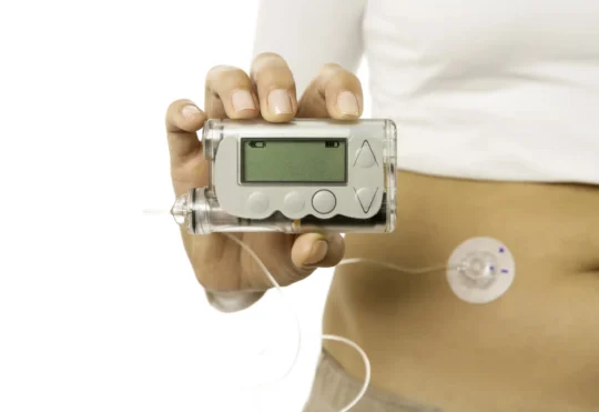 N.S. ditches age cap for insulin pump funding program