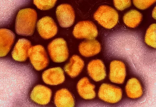 Mpox declared a global public health emergency for 2nd time