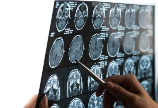 Mystery brain disease: Initial analysis complete, review underway