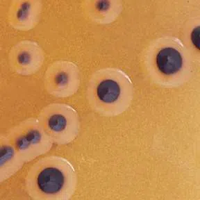 Outbreak of drug-resistant salmonella infections found in Canada: Public Health